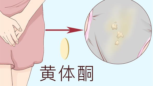 黄体酮催月经正确用法及有效食物推荐